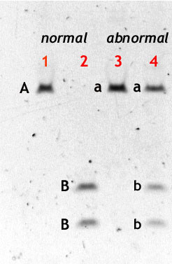 DNA restriction digest